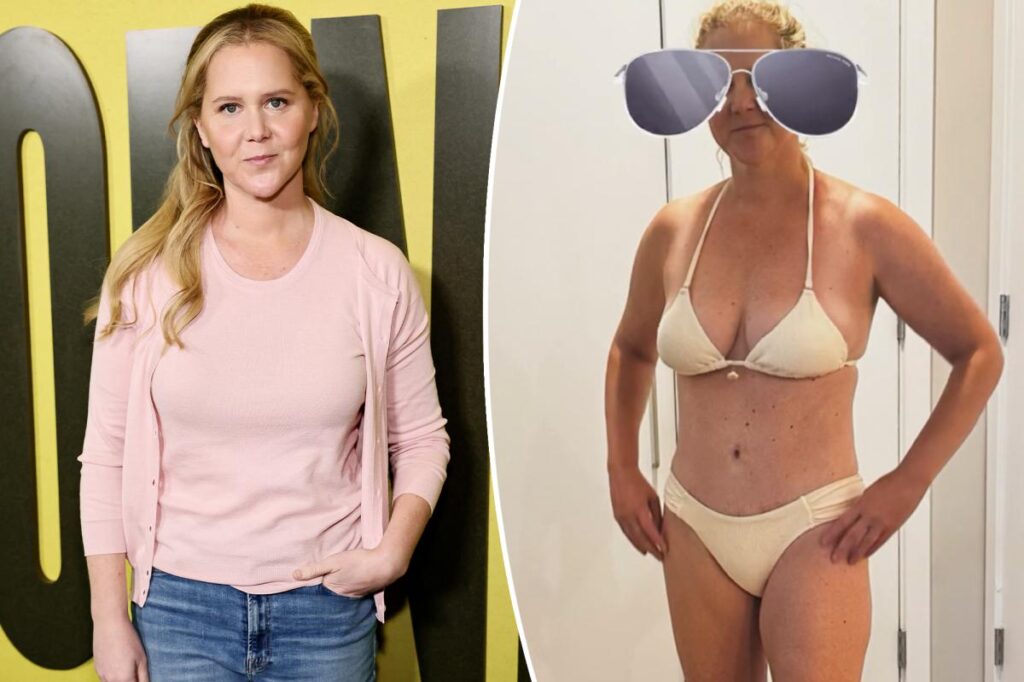 Amy Schumer shows off C-section scar in tiny bikini, boasts that she’s a ‘Warrior’ Amy Schumer shows off C-section scar in tiny bikini, boasts that she's a 'Warrior'
