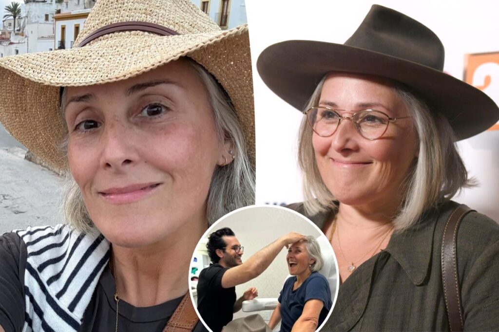 Ricki Lake shares unfiltered before-and-after photos to mark 2 years since facelift Ricki Lake shares unfiltered before-and-after photos to mark 2 years since facelift