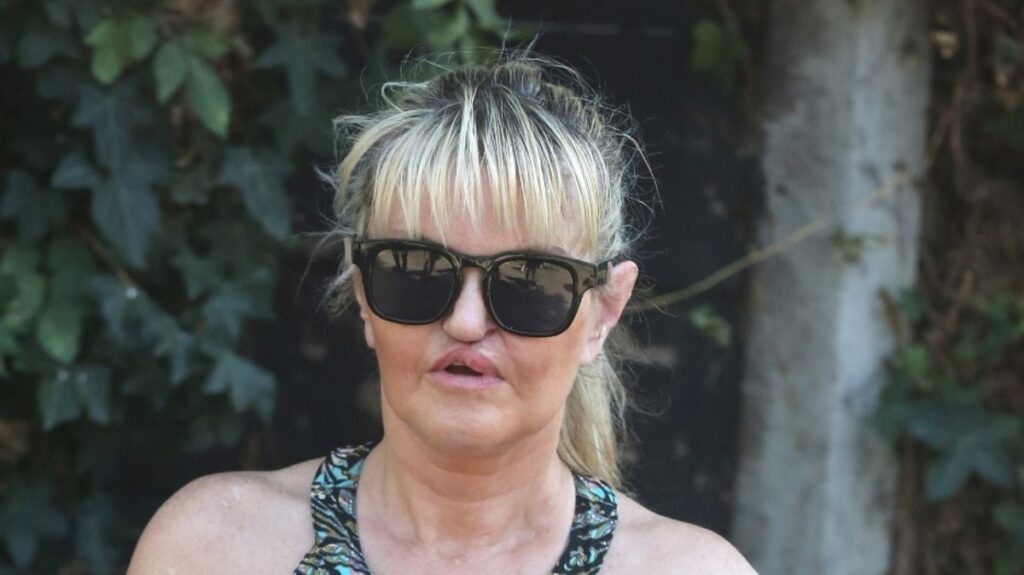 Danniella Westbrook’s glam new look after latest round of facial surgery Daily Mirror
