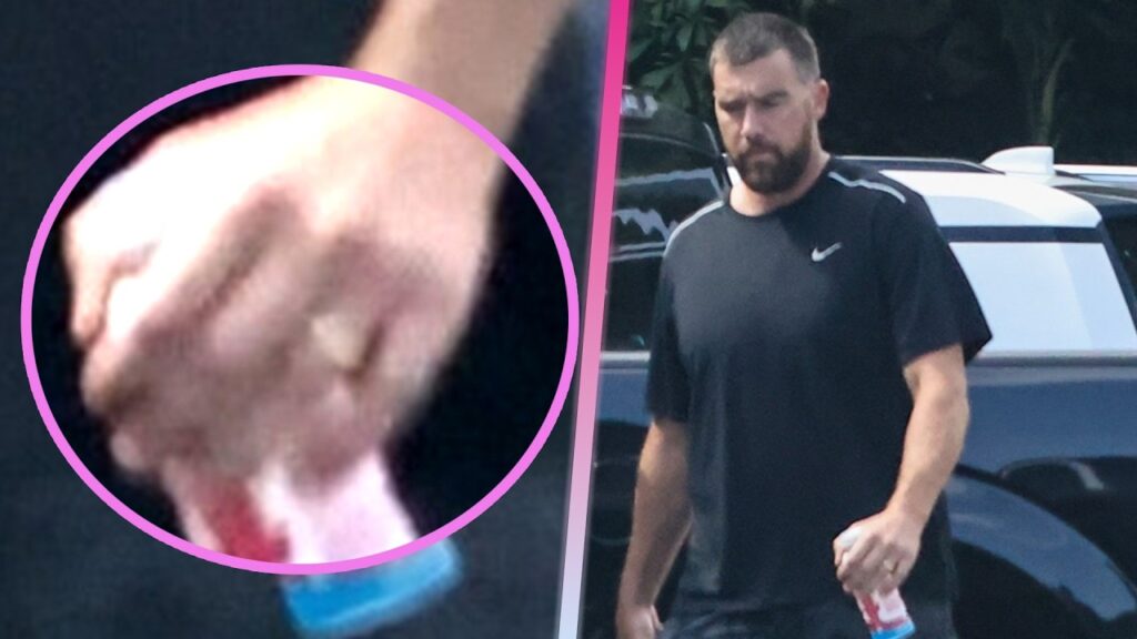 Travis Kelce Debuts Wedding Ring From Taylor Swift at Chiefs Training Camp Travis Kelce Debuts Wedding Ring From Taylor Swift at Chiefs Training Camp