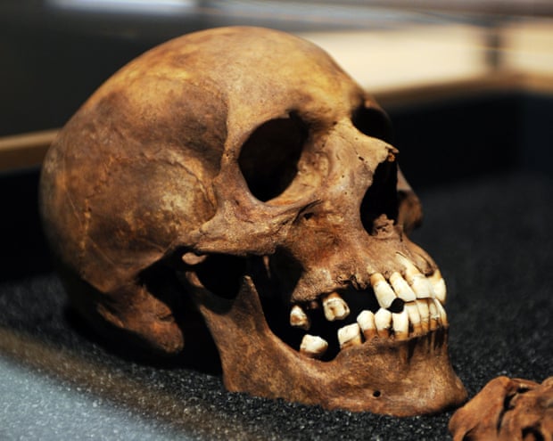 A skull