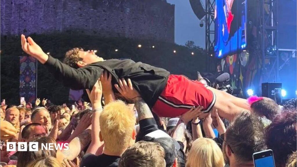 Bowling for Soup singer’s son dropped on head at Cardiff Castle A woman with dark hair pulled back from her face points to a plaster on her arm