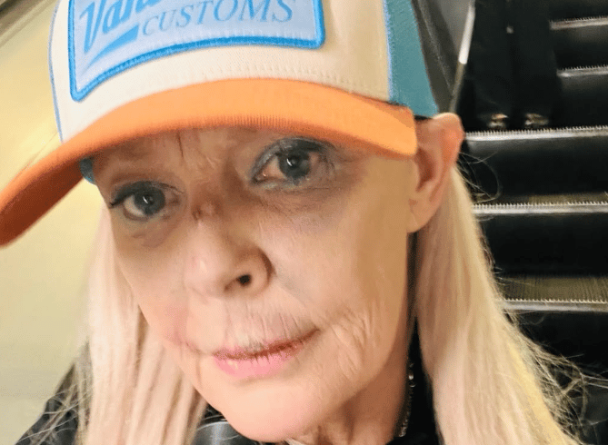 Gail Porter reveals badly bruised face after getting 'knocked over' in Tube station – London Evening Standard Gail Porter reveals badly bruised face after getting 'knocked over' in Tube station - London Evening Standard