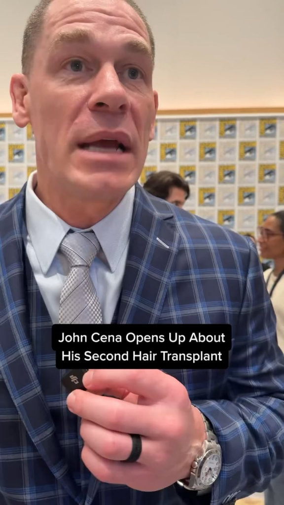 John Cena talks about his second hair transplant: “I have full trust and faith in him (his doctor) with this process.”