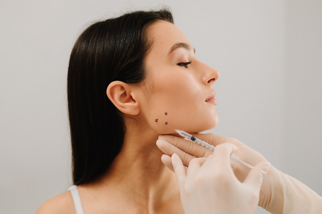 A woman receiving botulinum toxin injections for bruxism treatment.
