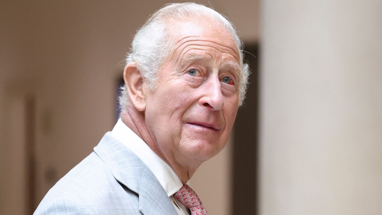 King Charles Must Carry Out a “Crucial Duty” Before Vacation King Charles has white gray hair and one of his eyes is bloodshot with a pink spot and he wears a light gray suit with a tie