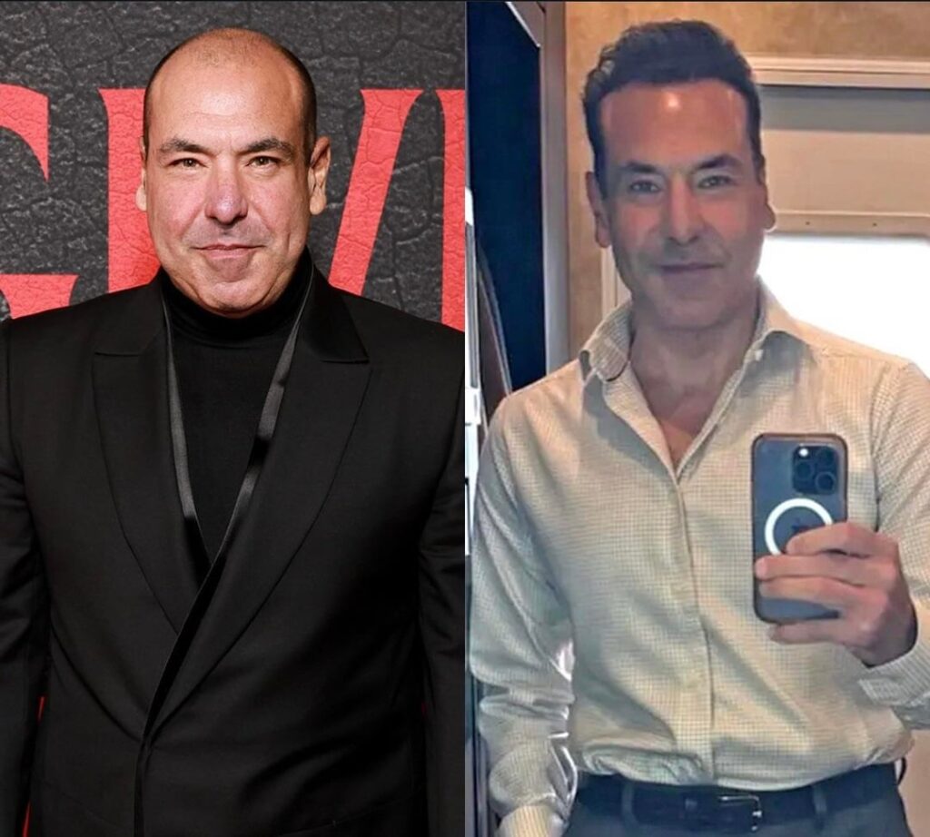 ‘Suits’ star Rick Hoffman unveiled a bit of a makeover in his most recent social media post